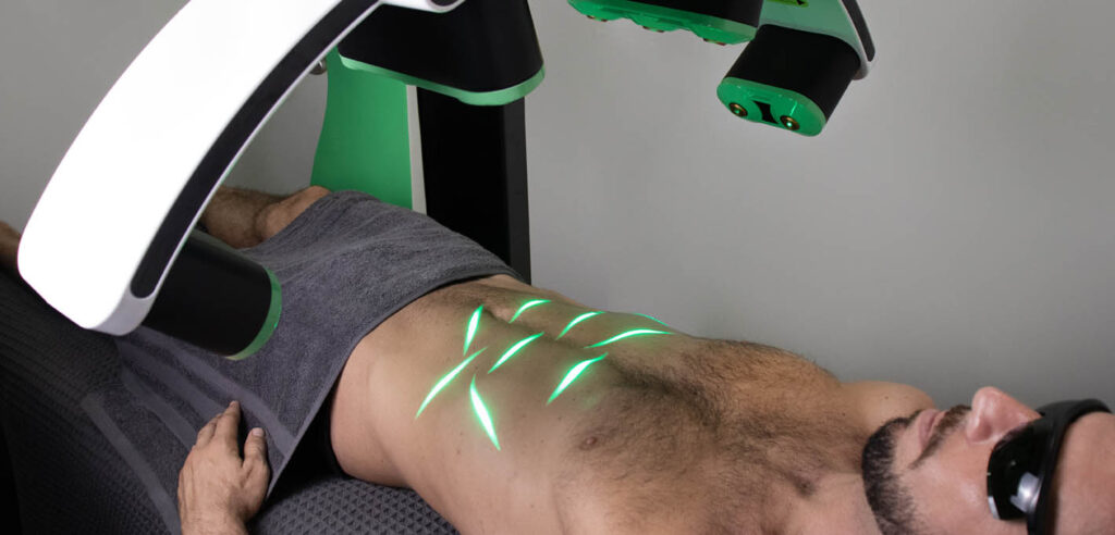 Green Laser Lipo