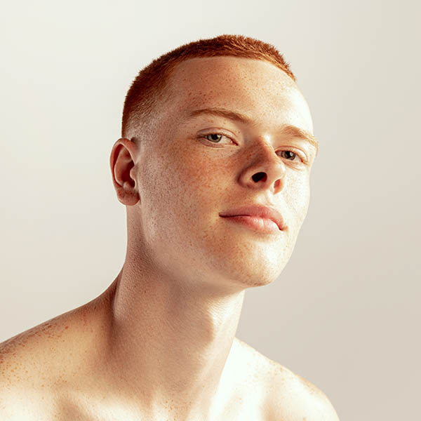 Laser Skin Rejuvenation