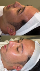 801D4CDF AEA5 4A1A AAE9 758DE55BB93F