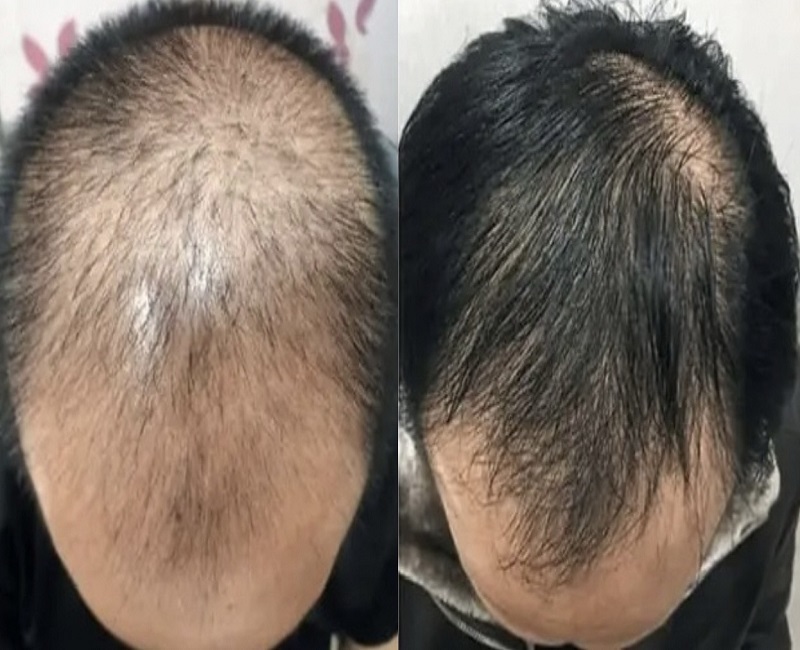 0BC0D560 7D3A 4ED9 BA1F 4590EC635A4E