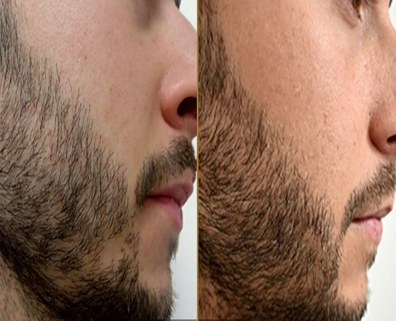 Facetune 31 03 2026 13 30 54