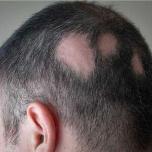 WhatsApp Image 2026 03 11 at 4.35.46 PM