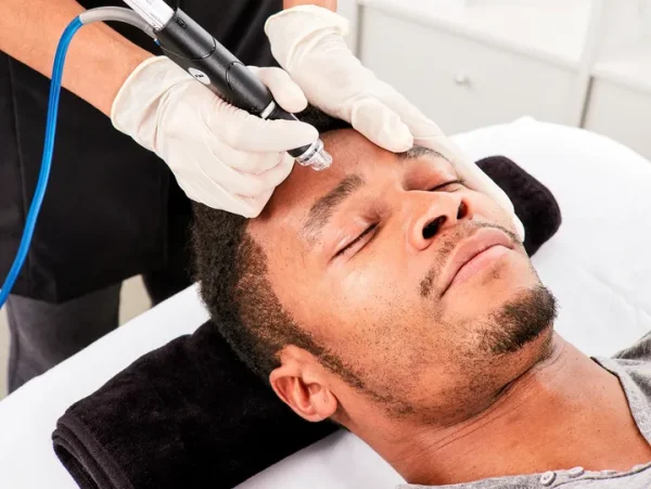 hydrafacial male 600x451